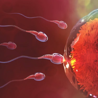 IUI –Intrauterine Insemination or Artificial Insemination (AI)